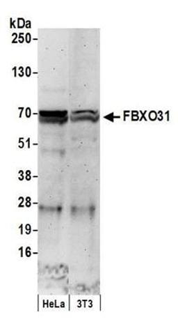 Detection of human and mouse FBXO31 by western blot.