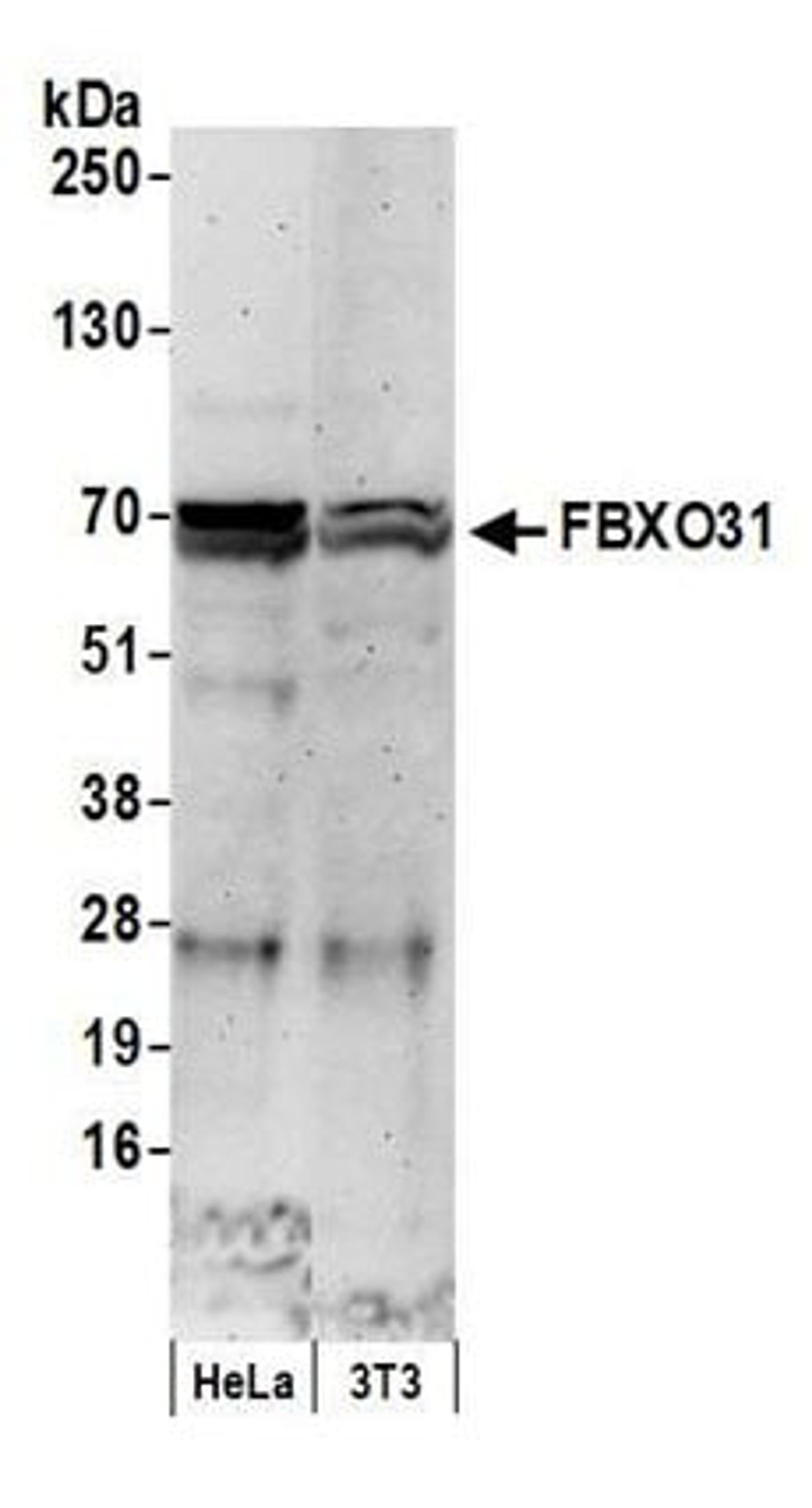 Detection of human and mouse FBXO31 by western blot.