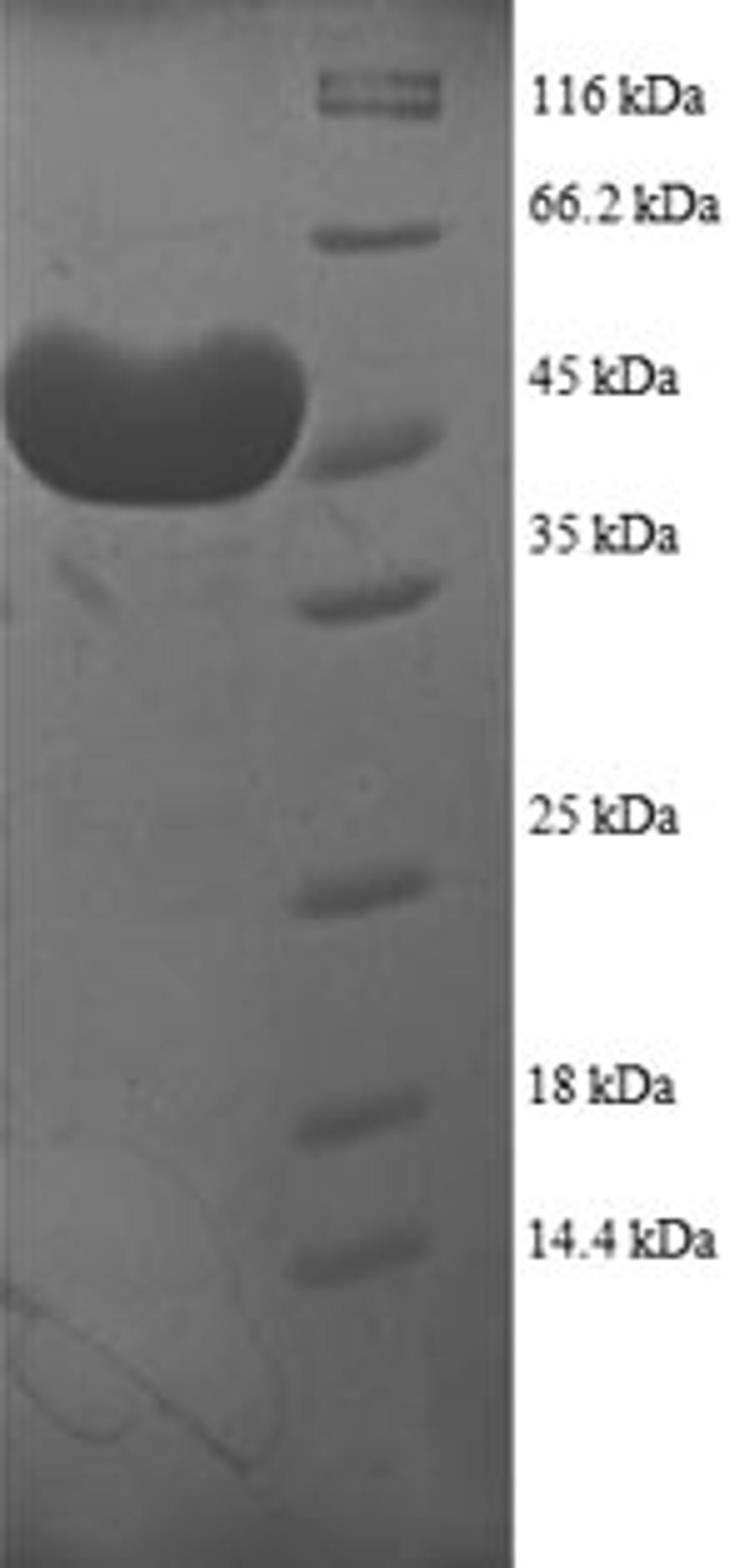 (Tris-Glycine gel) Discontinuous SDS-PAGE (reduced) with 5% enrichment gel and 15% separation gel.