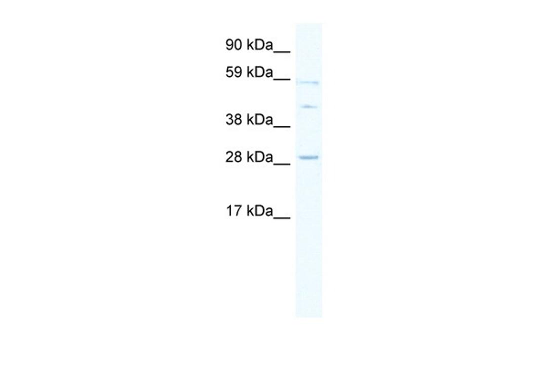 Antibody used in WB on Human Thymus lysate at 0.2-1 ug/ml.