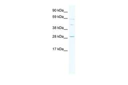 Antibody used in WB on Human Thymus lysate at 0.2-1 ug/ml.