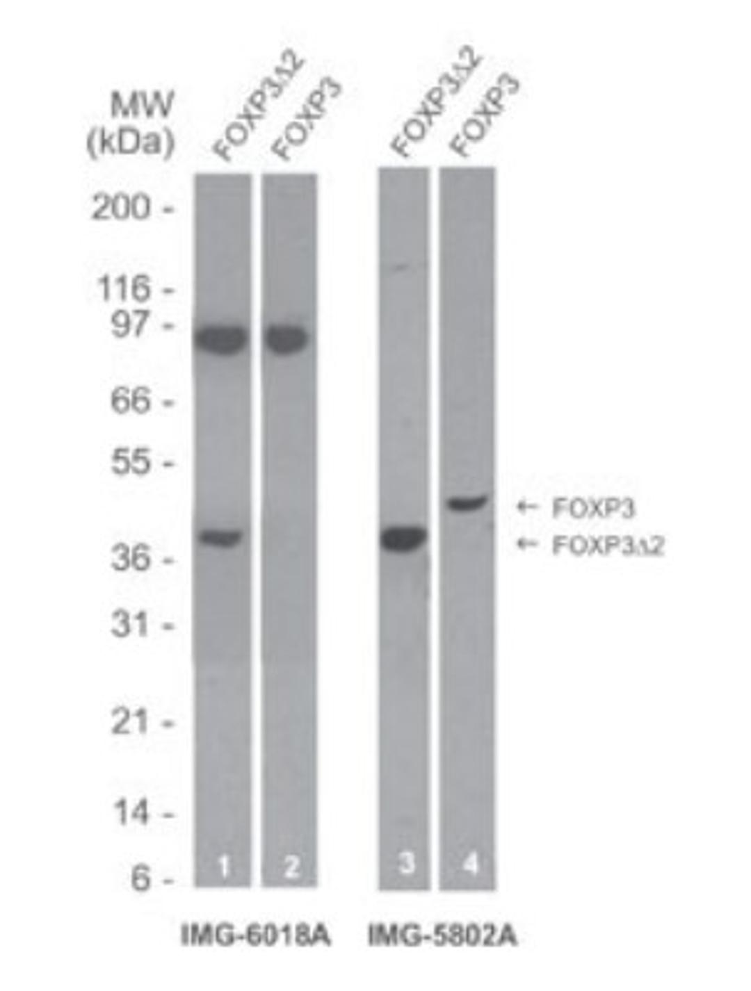 Western Blot: FOXP3 Delta 2 (exon 2 deleted) specific Antibody (16J4G6) [NBP2-24953] - Analysis of FOXP3D2 and full-length (wild-type) transfected 293 cell lysate using NBP2-24953 and FOXP3/Scurfin. At 1 ug/ml, NBP2-24953 specifically detects the FOXP3D2 (Lane 1); it does not detect full-length FOXP3 (Lane 2).  In contrast, FOXP3/Scurfin detects both FOXP3D2 (Lane 3) and full-length (Lane 4) FOXP3.