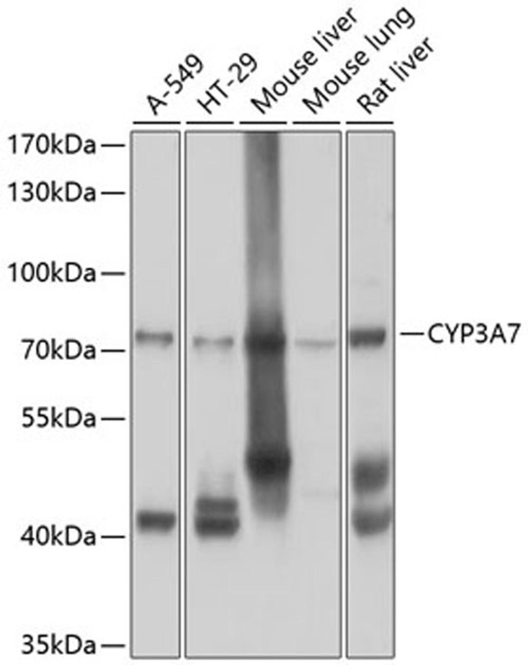 Western blot - CYP3A7 antibody (A10026)