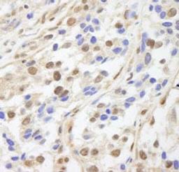 Detection of human UACA by immunohistochemistry.