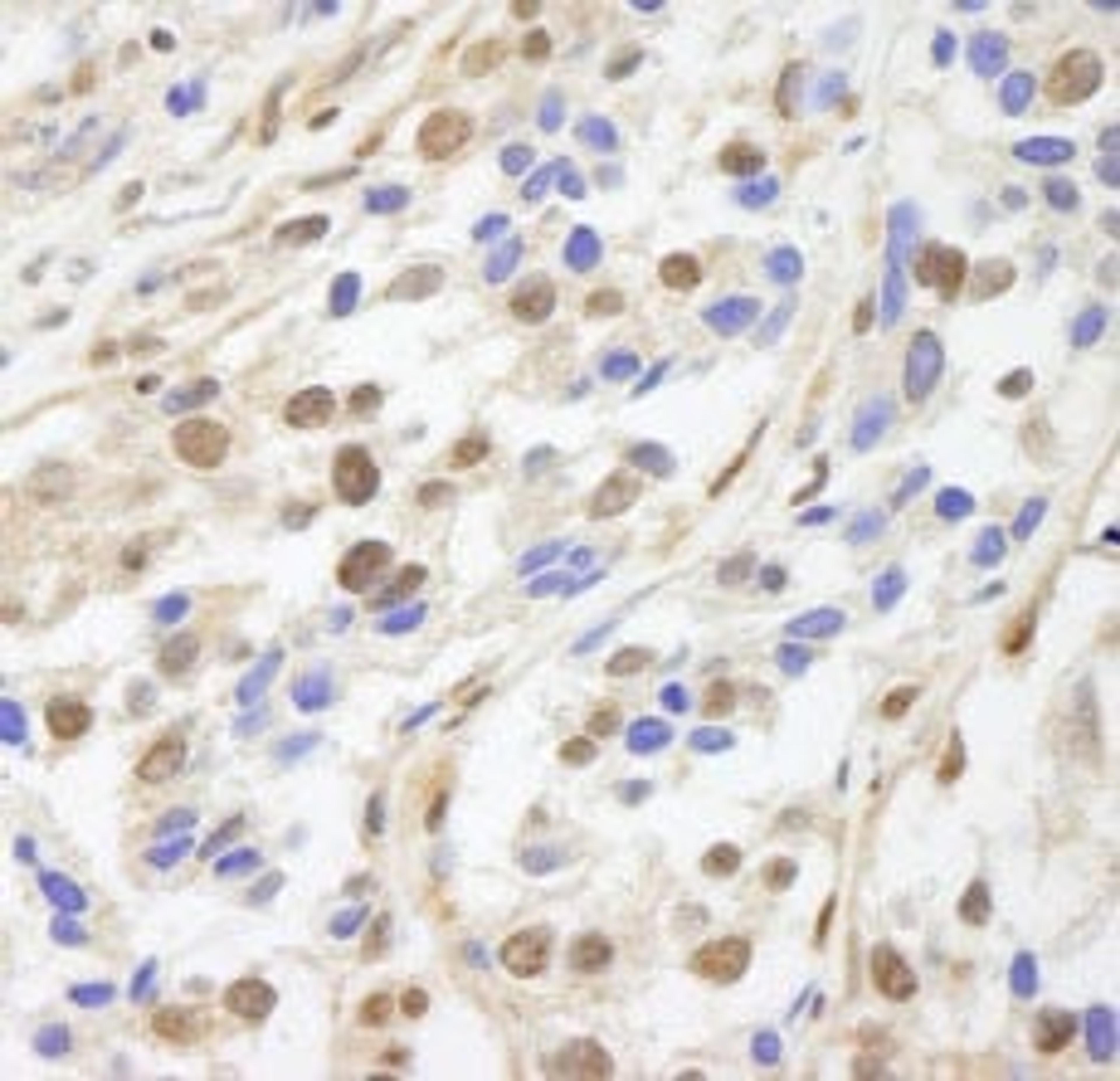 Detection of human UACA by immunohistochemistry.