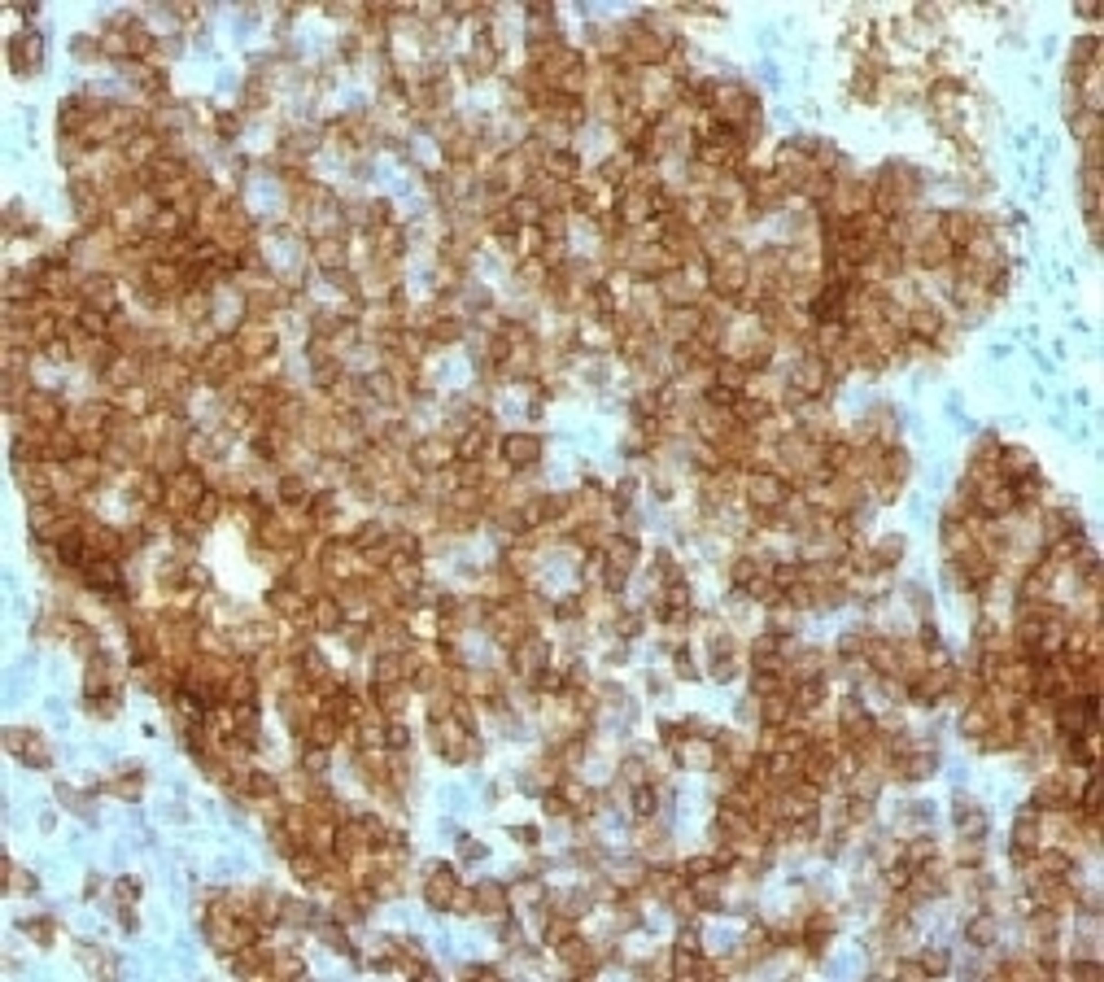 IHC test of FFPE human tonsil probed with anti-CD45RA antibody