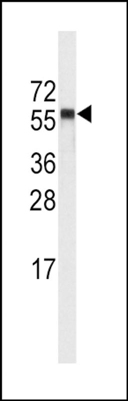 Western blot analysis of anti-CYP4A11 (4A22) Antibody in NCI-H460 cell line lysates (35ug/lane).