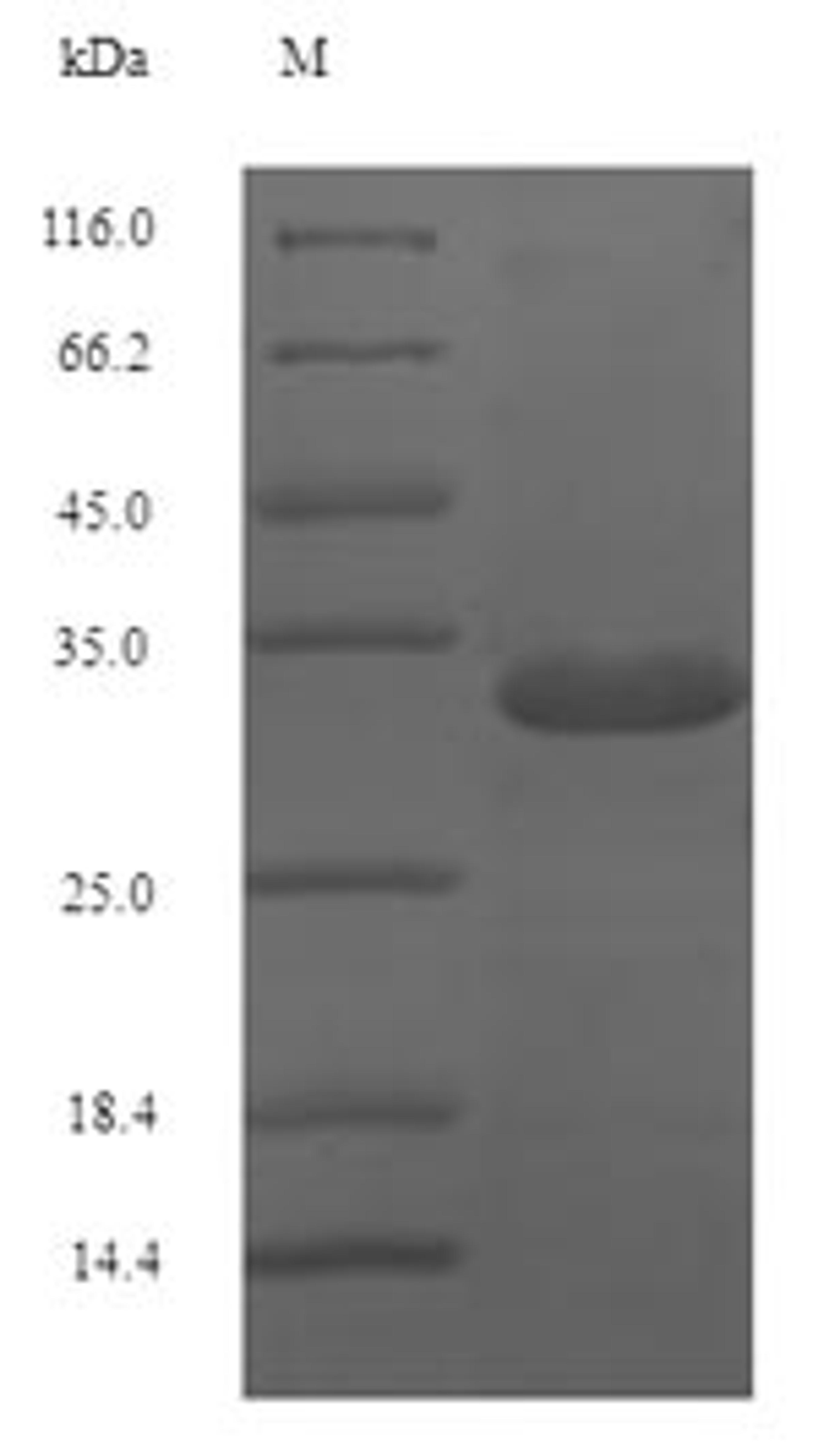 (Tris-Glycine gel) Discontinuous SDS-PAGE (reduced) with 5% enrichment gel and 15% separation gel.