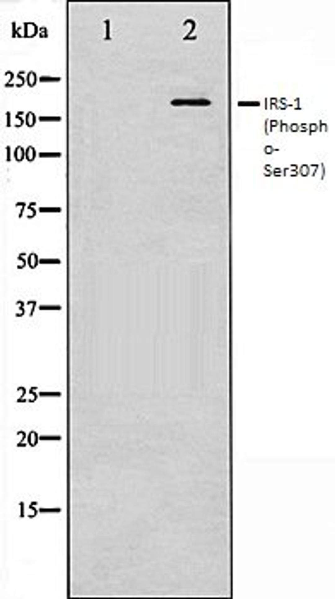 Western blot analysis of K562 whole cell lysates using IRS-1 (Phospho-Ser307) antibody, The lane on the left is treated with the antigen-specific peptide.