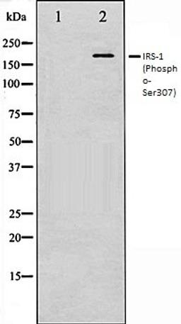 Western blot analysis of K562 whole cell lysates using IRS-1 (Phospho-Ser307) antibody, The lane on the left is treated with the antigen-specific peptide.