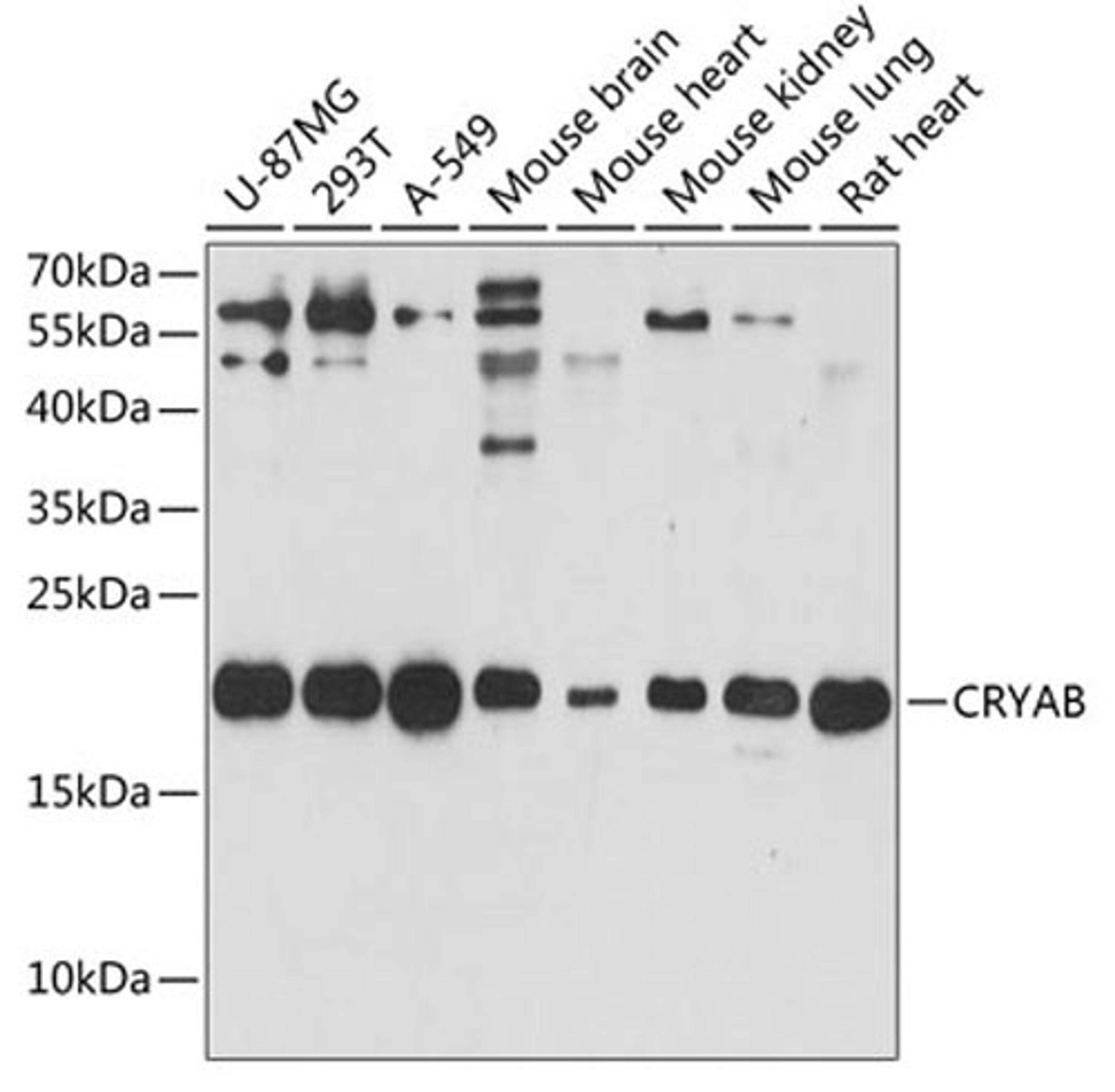 Western blot - CRYAB antibody (A13696)