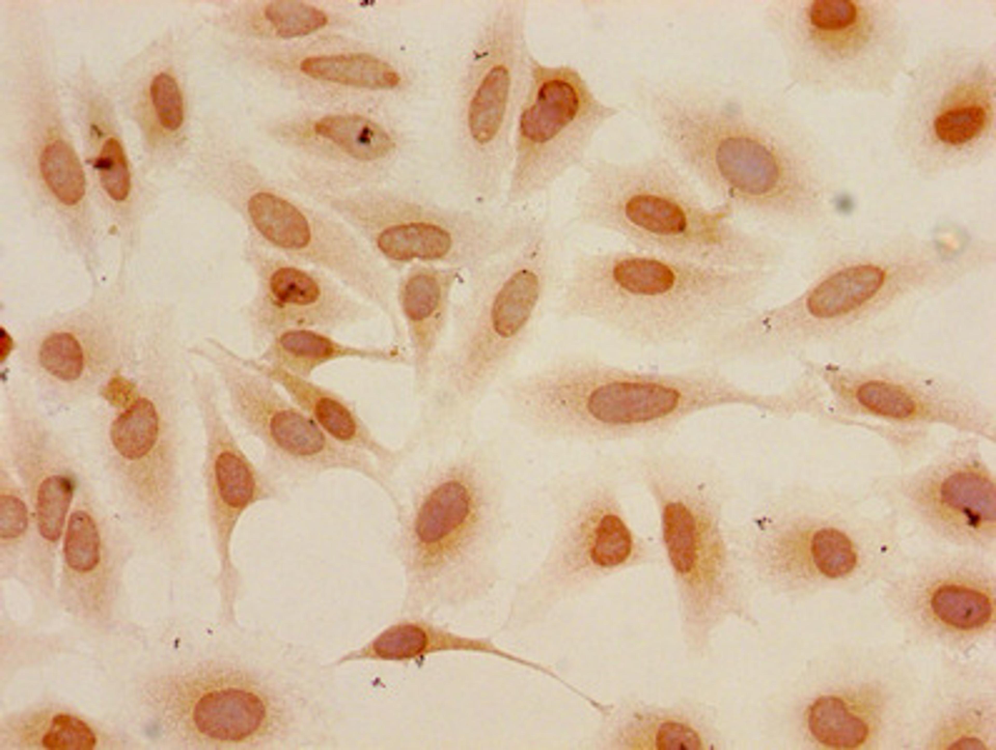 Immunocytochemistry analysis of Hela cells using CSB-PA010418PA04me2HU at dilution of 1:100
