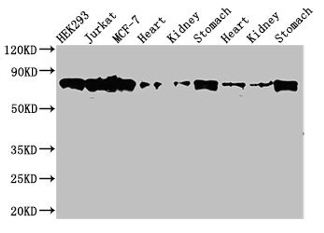 Western Blot. Positive WB detected in: HEK293 whole cell lysate, Jurkat whole cell lysate, MCF-7 whole cell lysate, Rat heart tissue, Rat kideny tissue, Rat stomach tissue, Mouse heart tissue, Mouse kidney tissue, Mouse stomach tissue. All lanes: PRKCH antibody at 3.5µg/ml. Secondary. Goat polyclonal to rabbit IgG at 1/50000 dilution. Predicted band size: 78, 60 kDa. Observed band size: 78 kDa