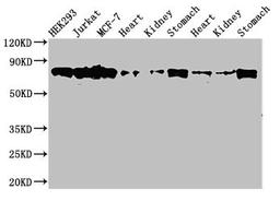 Western Blot. Positive WB detected in: HEK293 whole cell lysate, Jurkat whole cell lysate, MCF-7 whole cell lysate, Rat heart tissue, Rat kideny tissue, Rat stomach tissue, Mouse heart tissue, Mouse kidney tissue, Mouse stomach tissue. All lanes: PRKCH antibody at 3.5µg/ml. Secondary. Goat polyclonal to rabbit IgG at 1/50000 dilution. Predicted band size: 78, 60 kDa. Observed band size: 78 kDa
