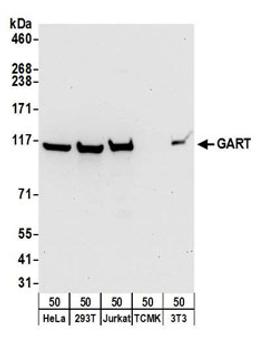 Detection of human and mouse GART by western blot.