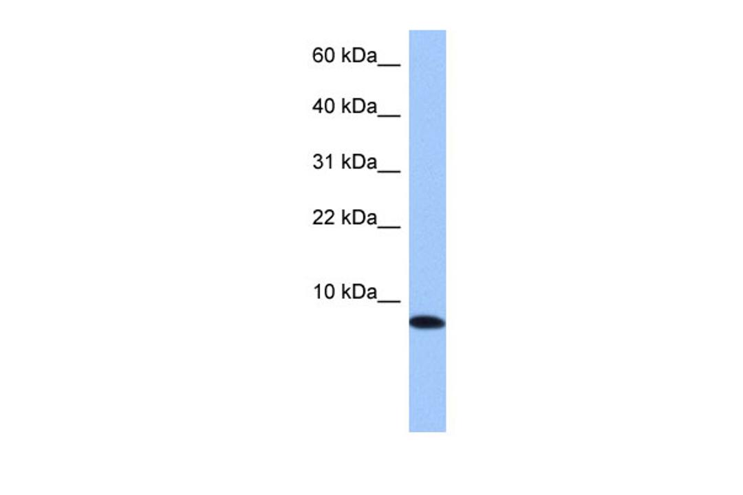 Antibody used in WB on Human 721_B at 0.2-1 ug/ml.