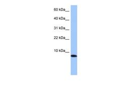 Antibody used in WB on Human 721_B at 0.2-1 ug/ml.