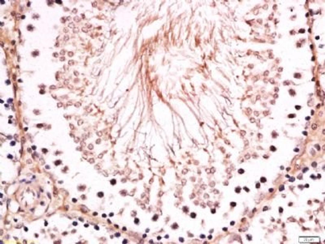 Immunohistochemical staining of rat testis tissue using BNC1 antibody.