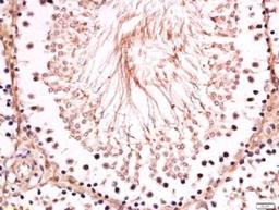 Immunohistochemical staining of rat testis tissue using BNC1 antibody.