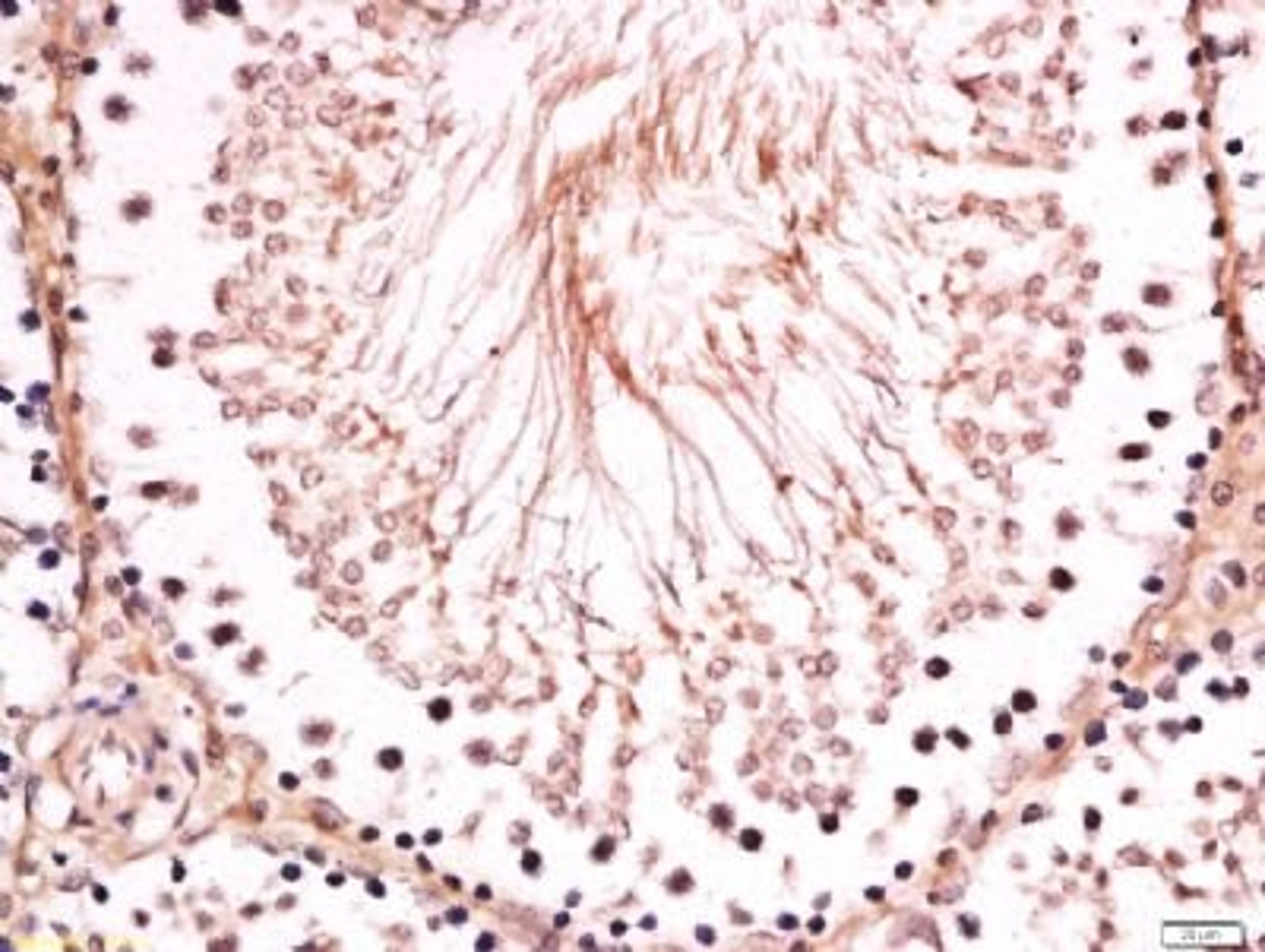 Immunohistochemical staining of rat testis tissue using BNC1 antibody.