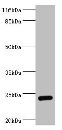 Western blot. All lanes: STXBP6 antibody at 2µg/ml + Mouse brain tissue. Secondary. Goat polyclonal to rabbit at 1/10000 dilution. Predicted band size: 24, 12 kDa. Observed band size: 24 kDa