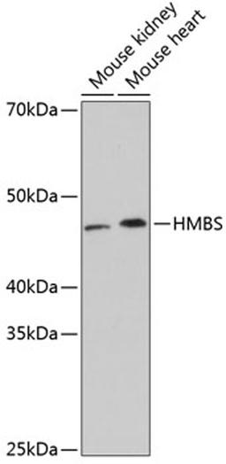 Western blot - HMBS Rabbit mAb (A11701)