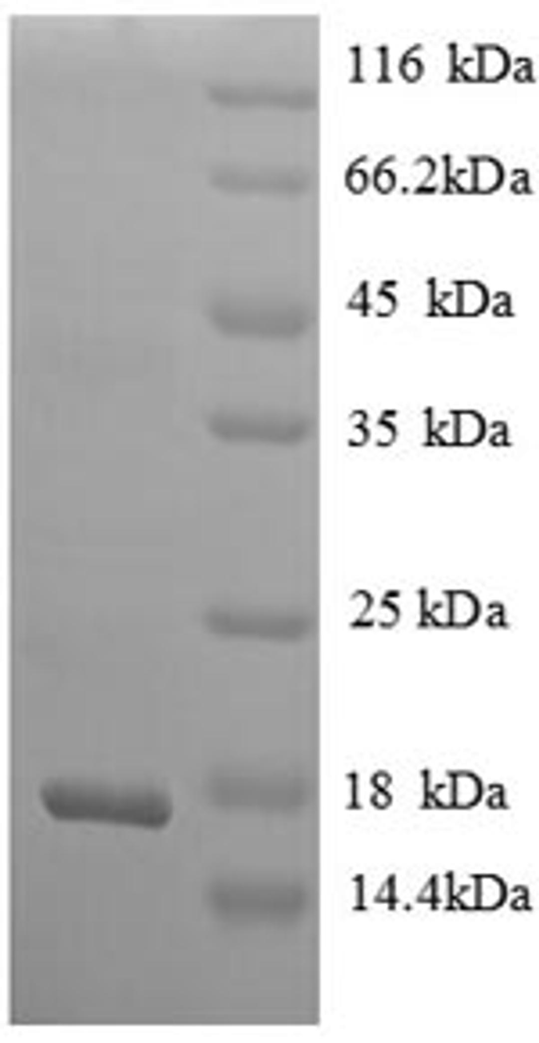 (Tris-Glycine gel) Discontinuous SDS-PAGE (reduced) with 5% enrichment gel and 15% separation gel.