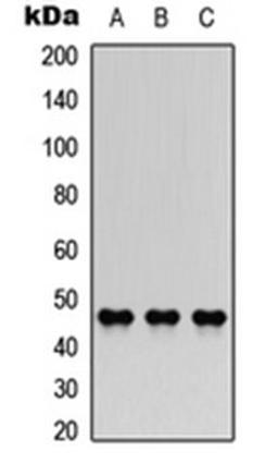 Western blot analysis of A549 (Lane 1), NS-1 (Lane 2), H9C2 (Lane 3) whole cell lysates using AChE Q antibody