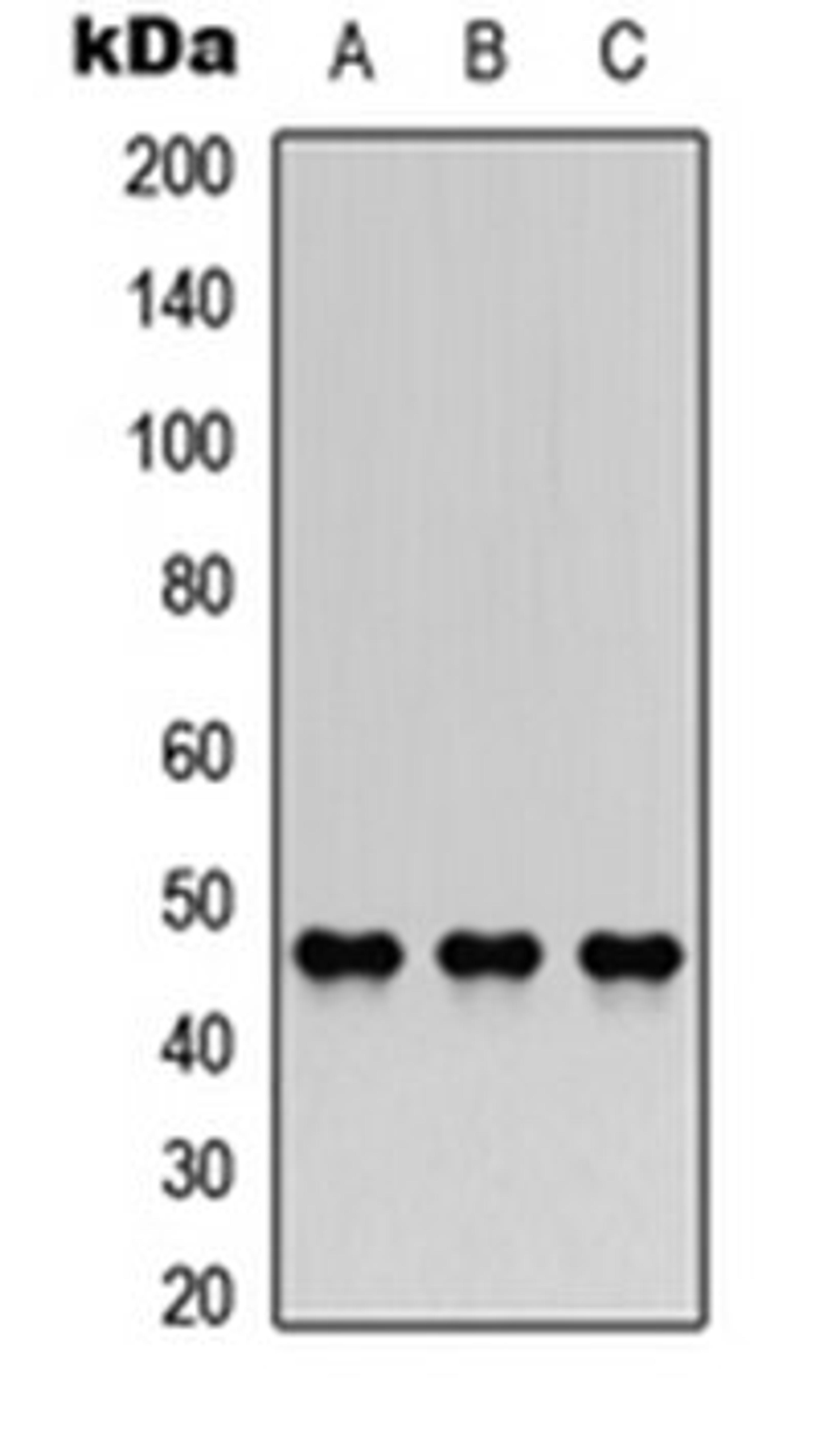 Western blot analysis of A549 (Lane 1), NS-1 (Lane 2), H9C2 (Lane 3) whole cell lysates using AChE Q antibody