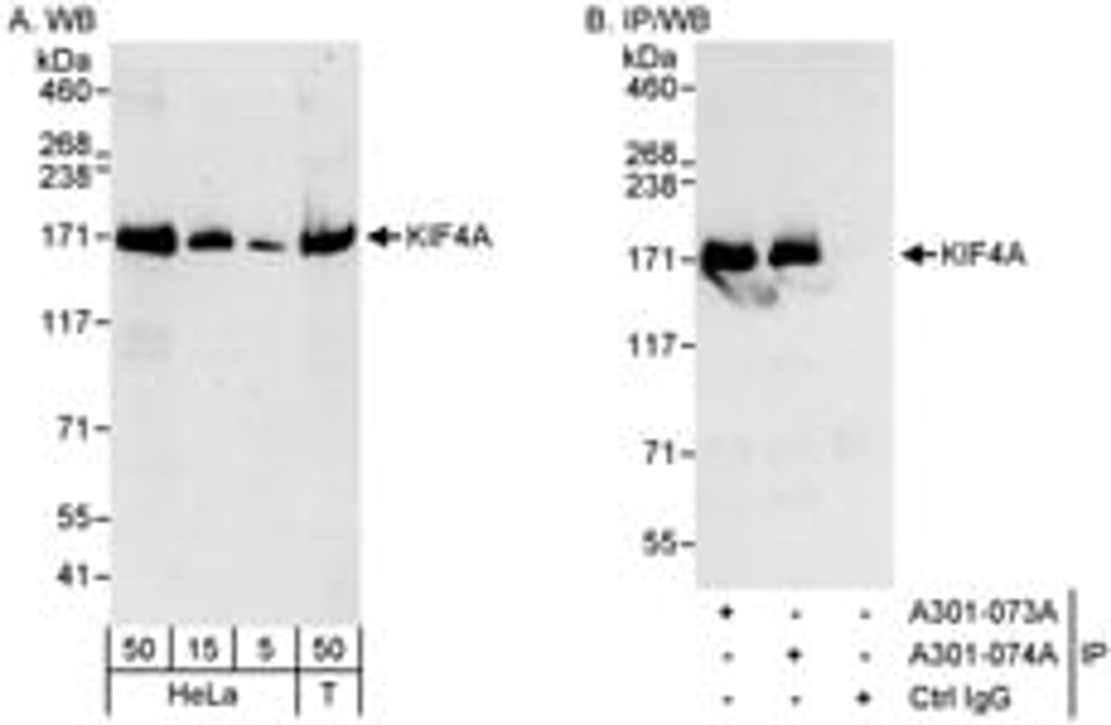 Detection of human KIF4A by western blot and immunoprecipitation.