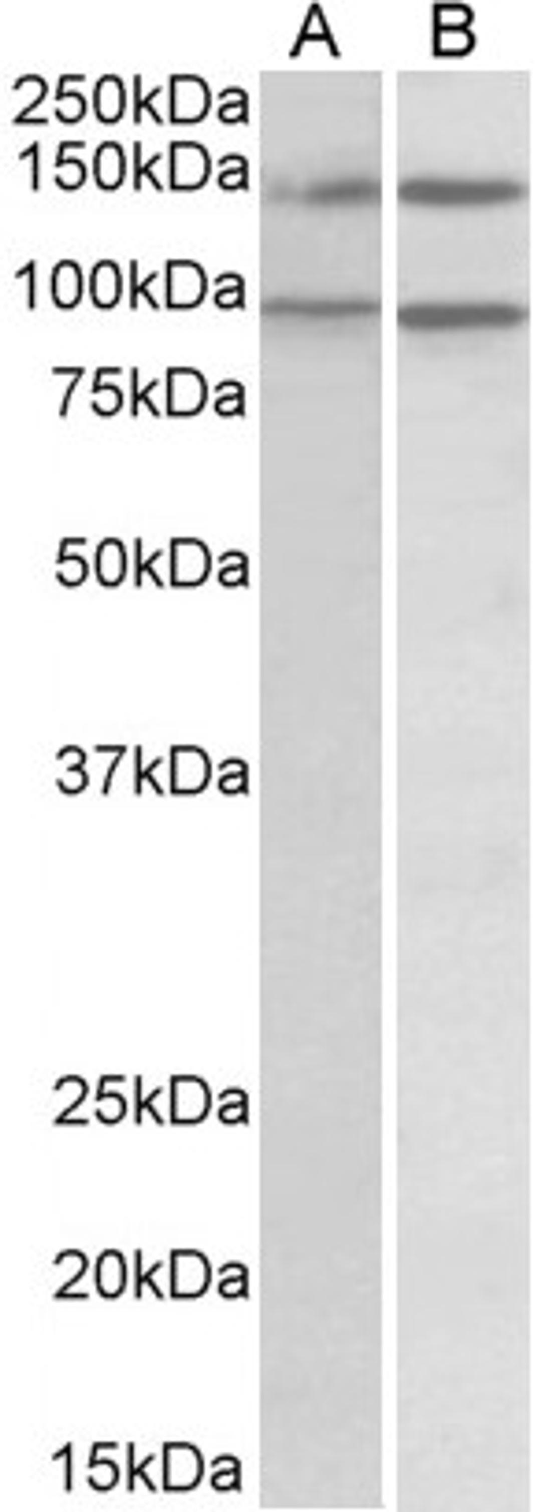 46-122 (0.5ug/ml) staining of lysates of cell lines Daudi (A) and Caco-2 (B) (35ug protein in RIPA buffer). Primary incubation was 1 hour. Detected by chemiluminescence.