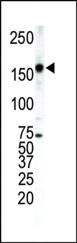 Western blot analysis of anti-ErbB4 Pab in T-47D cell lysate