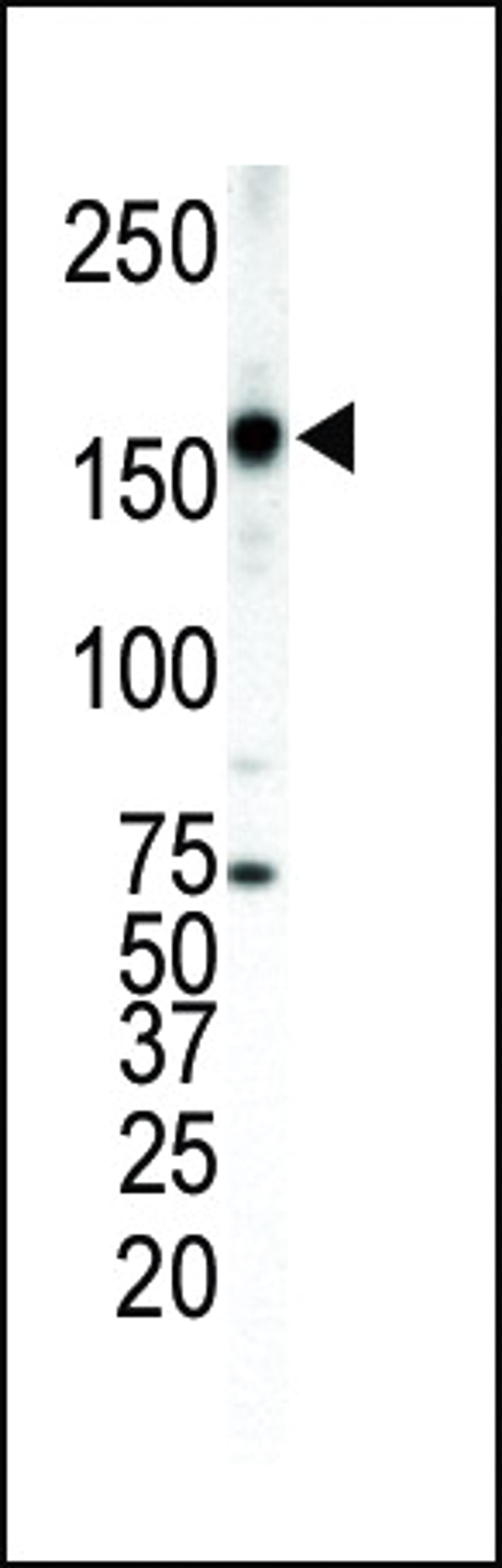 Western blot analysis of anti-ErbB4 Pab in T-47D cell lysate