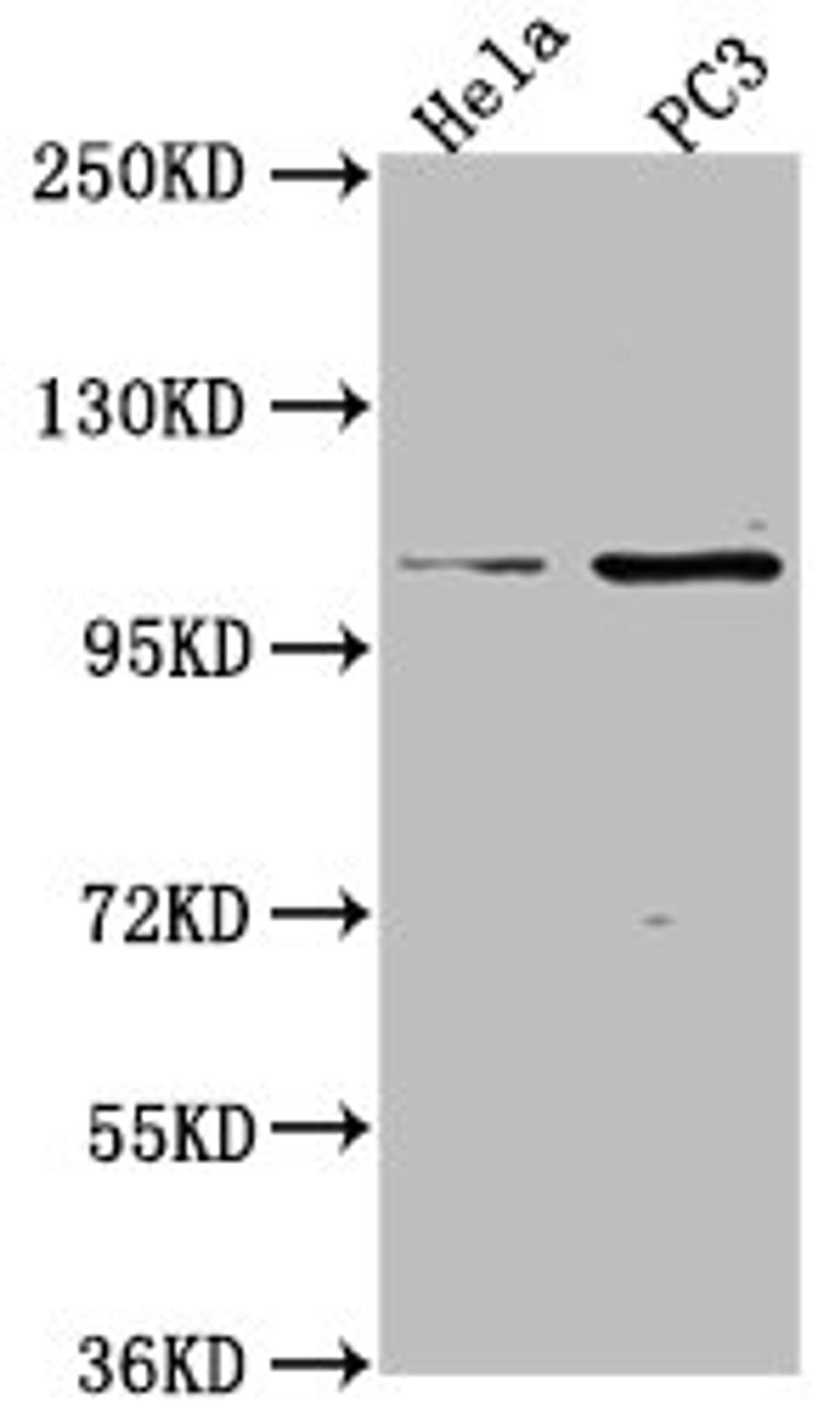 Western Blot. Positive WB detected in: Hela whole cell lysate, PC3 whole cell lysate. All lanes: PKN3 antibody at 1:2000. Secondary. Goat polyclonal to rabbit IgG at 1/50000 dilution. Predicted band size: 100 kDa. Observed band size: 100 kDa.