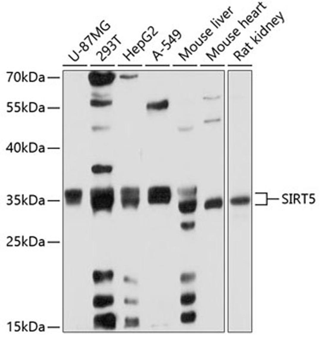 Western blot - SIRT5 antibody (A5784)