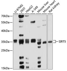 Western blot - SIRT5 antibody (A5784)