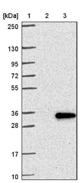 Western Blot: NR6 Antibody [NBP1-89926] - Lane 1: Marker [kDa] 250, 130, 95, 72, 55, 36, 28, 17, 10<br/>Lane 2: Negative control (vector only transfected HEK293T lysate)<br/>Lane 3: Over-expression lysate (Co-expressed with a C-terminal myc-DDK tag (~3.1 kDa) in mammalian HEK293T cells, LY402229)