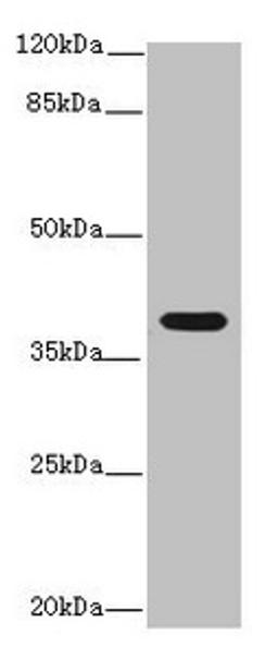 Western blot. All lanes: Interleukin-12 subunit beta antibody at 14ug/ml + K562 whole cell lysate. Secondary. Goat polyclonal to rabbit IgG at 1/10000 dilution. Predicted band size: 37 kDa. Observed band size: 37 kDa. 