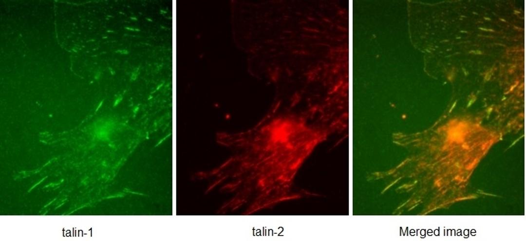 Murine embryonic fibroblast stained with Mouse anti talin 1 antibody