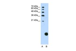 Antibody used in WB on Human Jurkat 1.25 ug/ml.