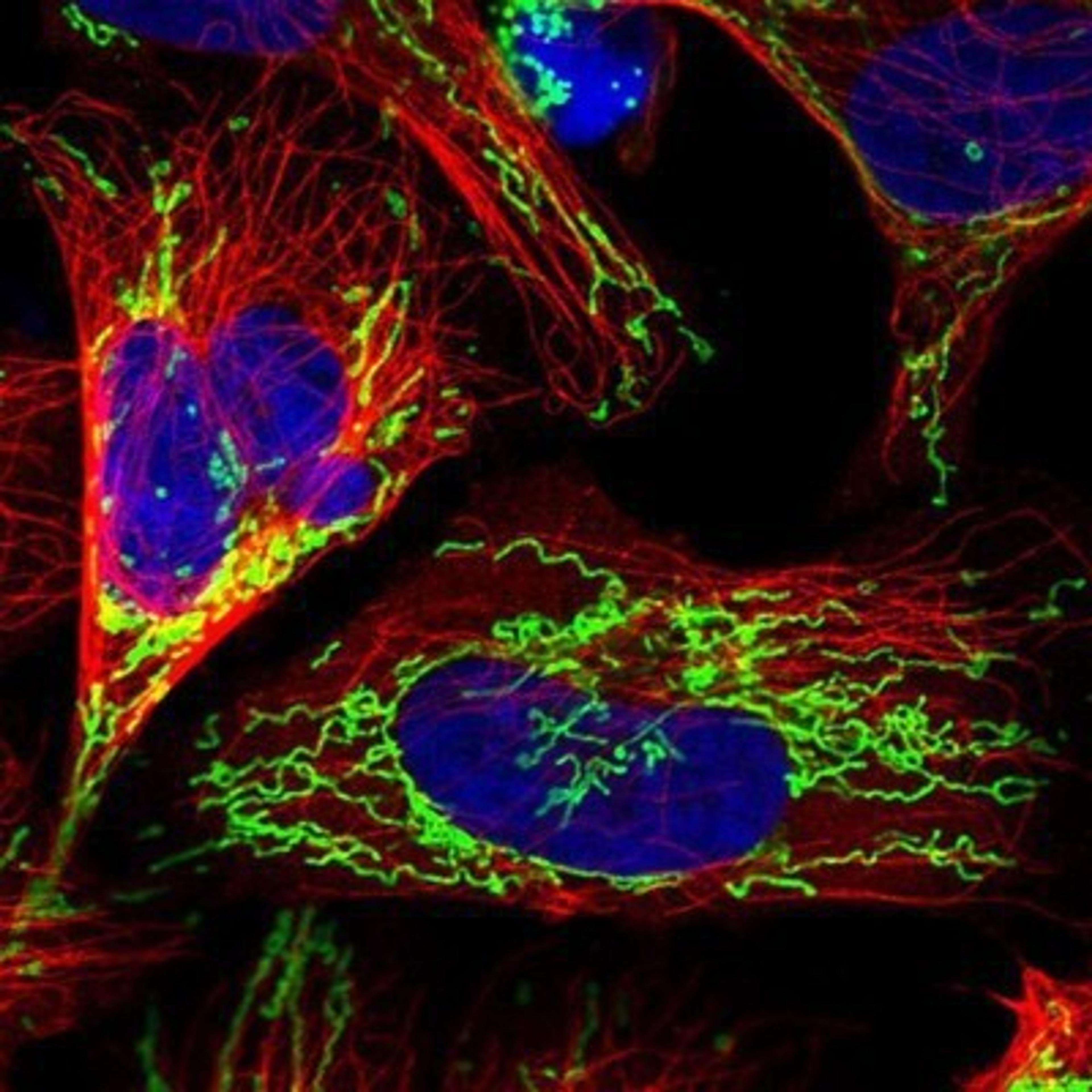 Immunocytochemistry/Immunofluorescence: COX5b Antibody [NBP1-89499] - Staining of human cell line U-2 OS shows positivity in mitochondria.