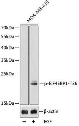 Western blot - Phospho-EIF4EBP1-T36 antibody (AP0344)