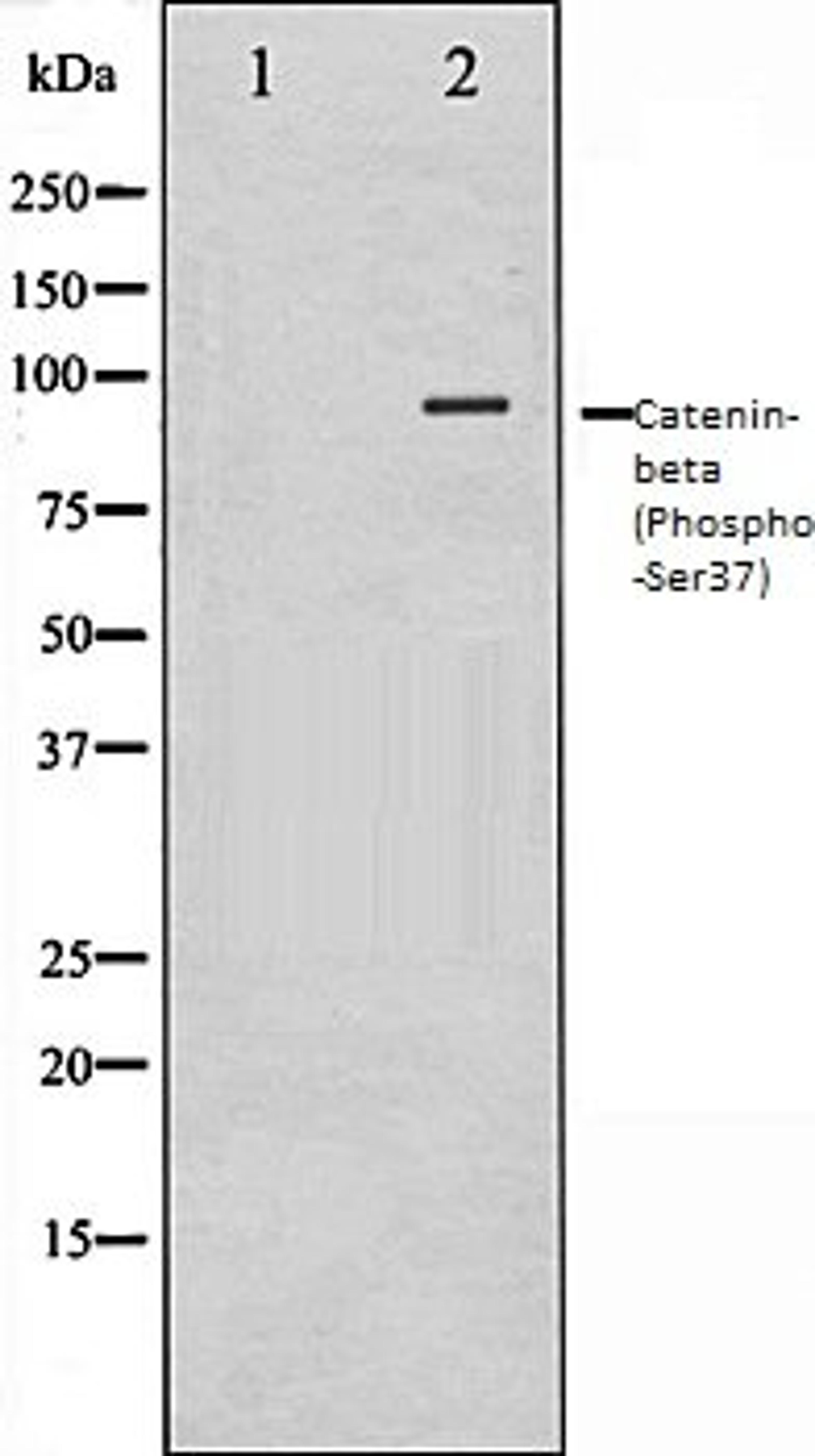 Western blot analysis of 293 whole cell lysates using Catenin-? (Phospho-Ser37) antibody, The lane on the left is treated with the antigen-specific peptide.