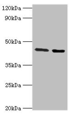 Western blot. All lanes: CHRFAM7A antibody at 3ug/ml. Lane 1: Jurkat whole cell lysate. Lane 2: Rat liver tissue. Secondary. Goat polyclonal to rabbit IgG at 1/10000 dilution. Predicted band size: 46 kDa. Observed band size: 46 kDa.