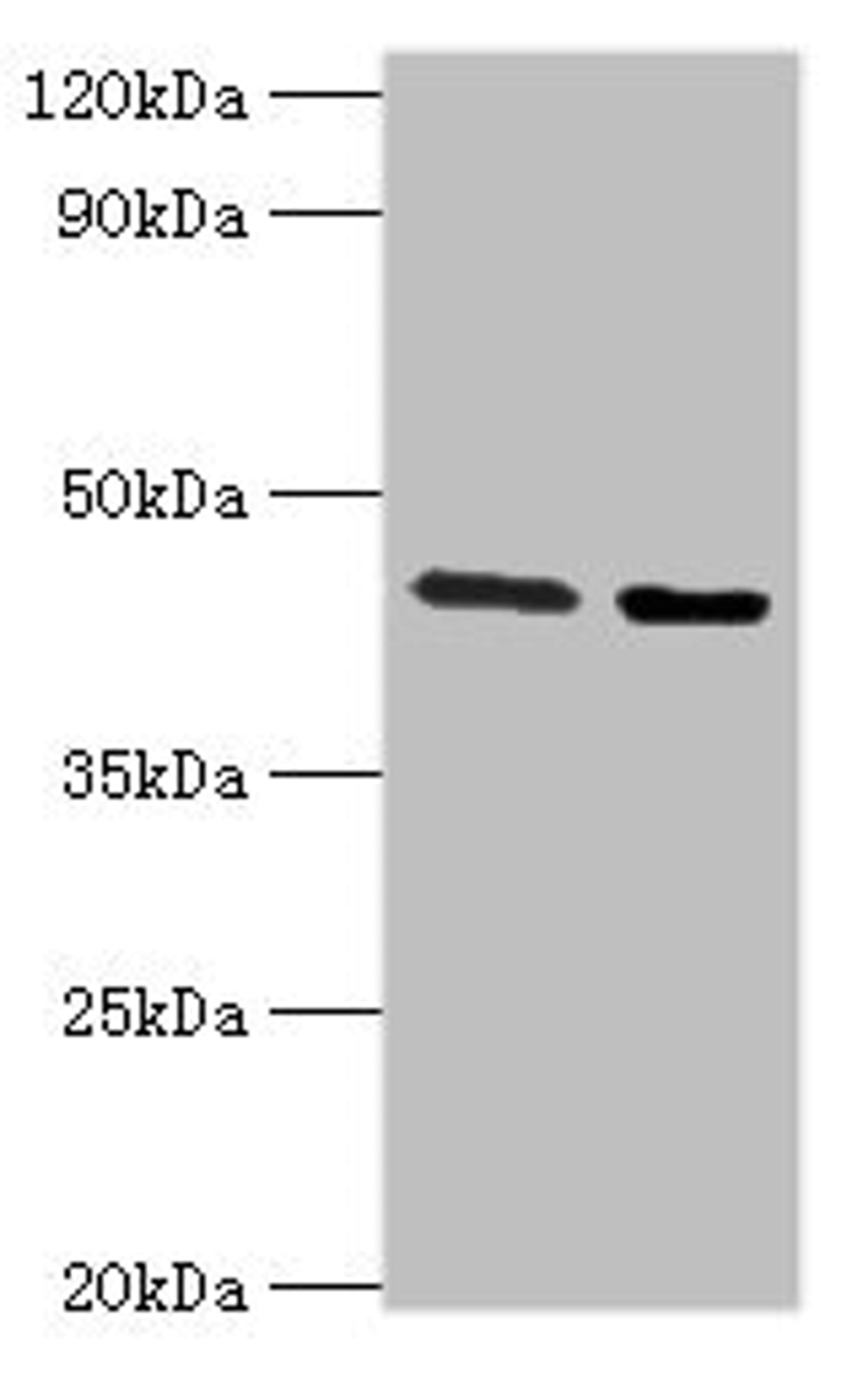 Western blot. All lanes: CHRFAM7A antibody at 3ug/ml. Lane 1: Jurkat whole cell lysate. Lane 2: Rat liver tissue. Secondary. Goat polyclonal to rabbit IgG at 1/10000 dilution. Predicted band size: 46 kDa. Observed band size: 46 kDa.