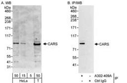 Detection of human CARS by western blot and immunoprecipitation.