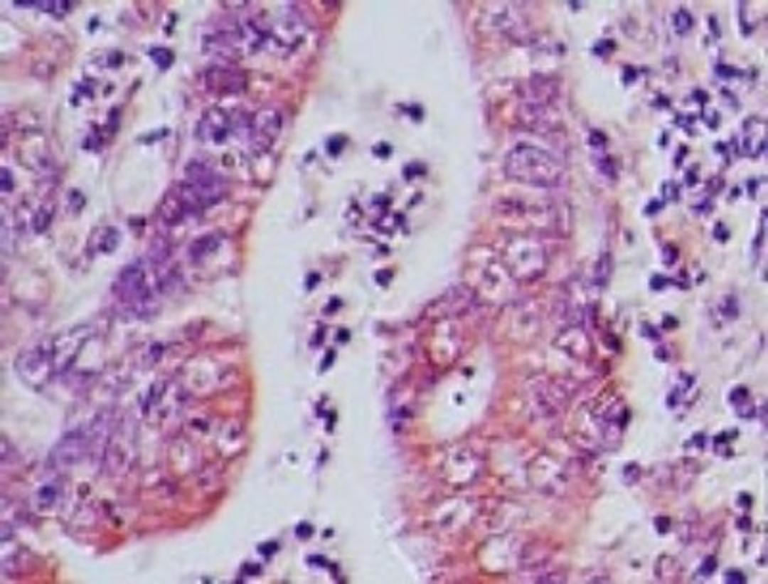 Immunohistochemistry-Paraffin: AP3D1 Antibody [NBP2-27158] - IHC of human rectum tissue probed with AP3 Delta antibody at 5 ug/ml.