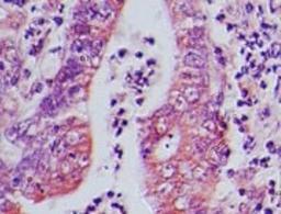 Immunohistochemistry-Paraffin: AP3D1 Antibody [NBP2-27158] - IHC of human rectum tissue probed with AP3 Delta antibody at 5 ug/ml.