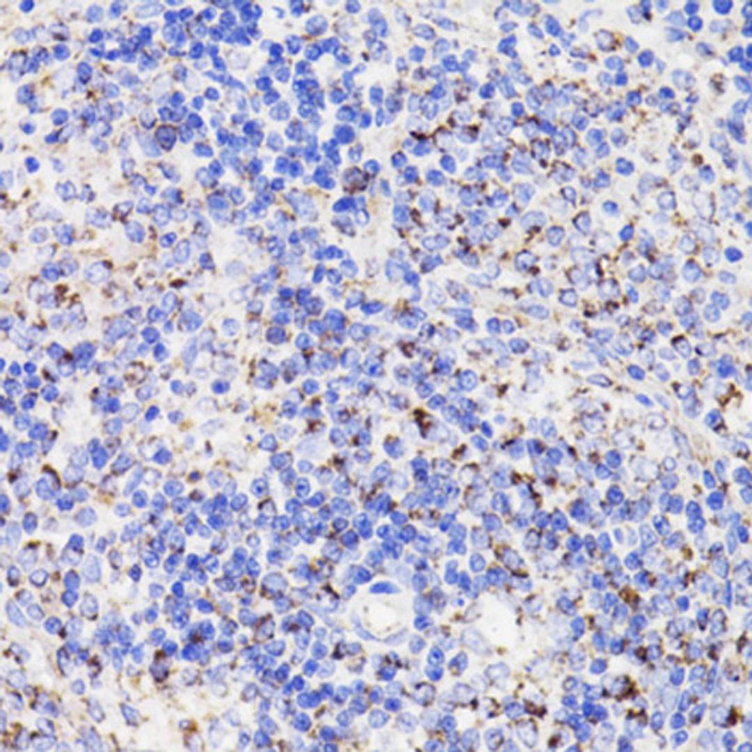 Immunohistochemistry  - PDCD10 antibody (A17094)