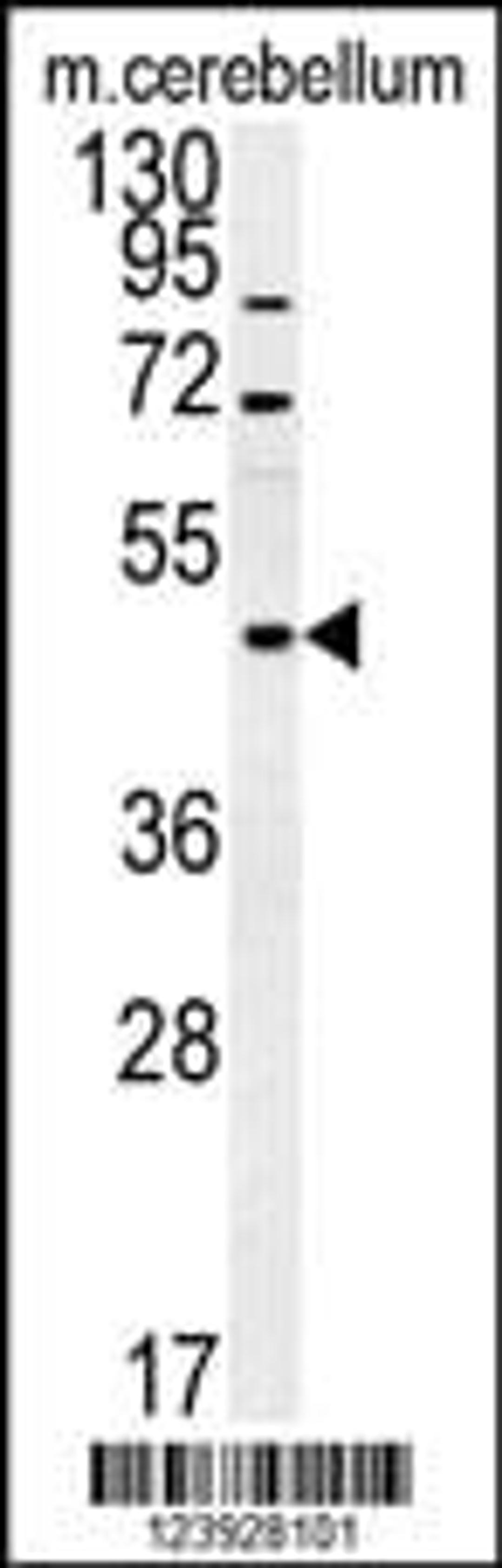 Western blot analysis in mouse cerebellum tissue lysates (15ug/lane).This demonstrates the detected FUS protein (arrow).